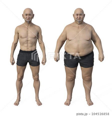 A normal weight man and the same man in an overweight condition, highlighting the anatomical and physiological differences, 3D illustration 104516858