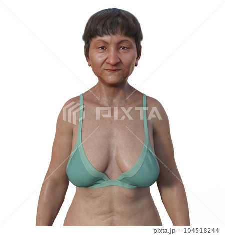 A 3D photorealistic illustration featuring the upper half part of a senior Asian woman, revealing her skin, facial expressions, and intricate body anatomy 104518244
