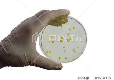 Colonies of different bacteria and mold fungi grown on Petri dish with nutrient agar Colonies of different bacteria and mold fungi grown on Petri dish with nutrient agar 104518415
