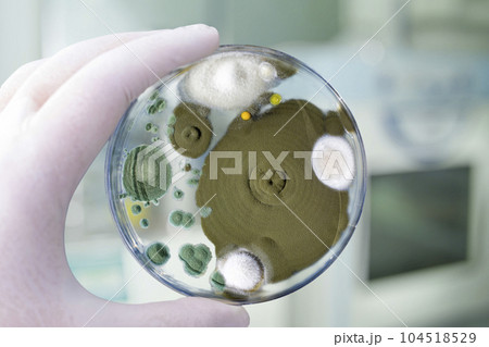 Colonies of different mold fungi grown from indoor air 104518529