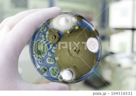Colonies of different mold fungi grown from indoor air 104518531