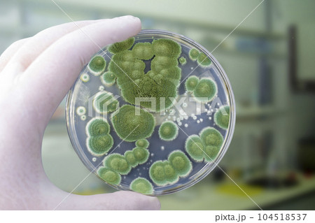 Colonies of different mold fungi grown from indoor air 104518537