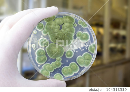 Colonies of different mold fungi grown from indoor air 104518539