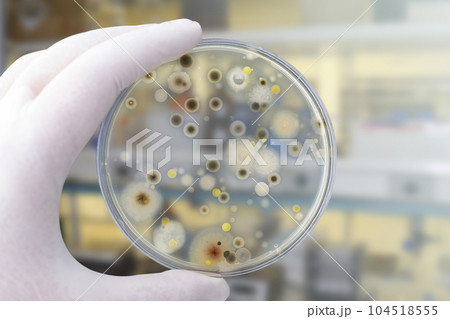 Colonies of different bacteria and mold fungi grown from indoor air 104518555