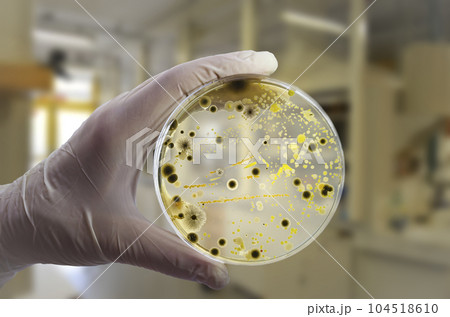 Colonies of different bacteria and mold fungi grown from indoor air 104518610