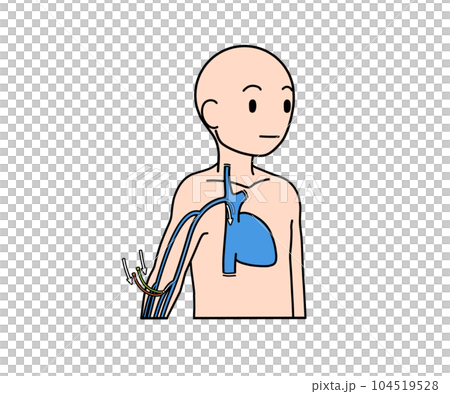 PICCカテーテル 104519528