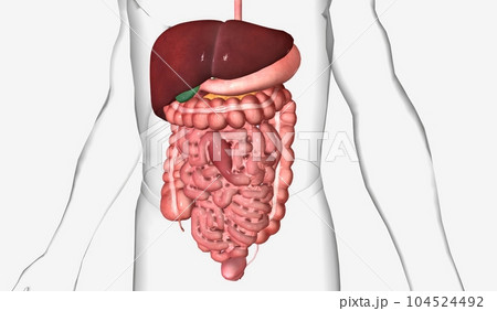 Abdominal adhesions are bands fibrous tissue formed after surgery between the abdominal organs and surrounding tissues 104524492
