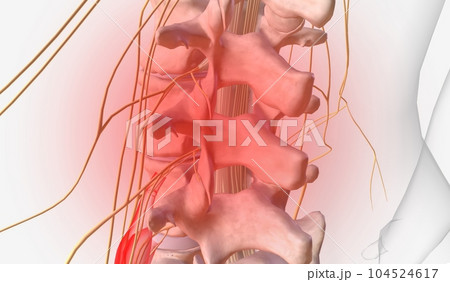 Back and Lower Limb Pain Back and Lower Limb Pain 104524617