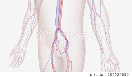Will insert a catheter through a large artery near the groin or Will insert a catheter through a large artery near the groin or 104524639