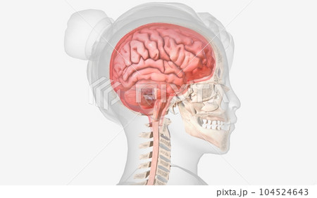 The Causes of Intracranial Pressure 104524643