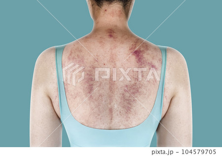 身体 体 胴体 104579705