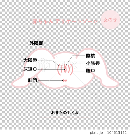 赤ちゃんデリケートゾーン:おまた 女の子(説明イメージ付き) 赤ちゃんデリケートゾーン:おまた 女の子(説明イメージ付き) 104615132