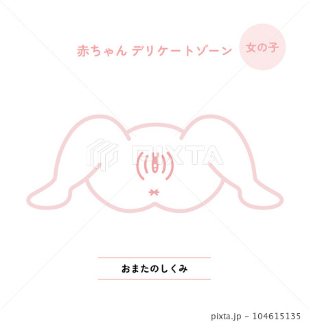 赤ちゃんデリケートゾーン:おまた 女の子 赤ちゃんデリケートゾーン:おまた 女の子 104615135