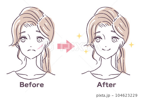 顔の傷　消す　治療　ビフォーアフター　人物女性　イラスト素材 104623229