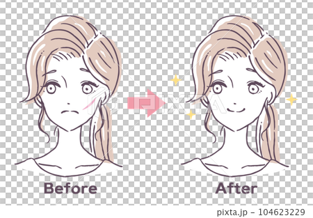 顔の傷　消す　治療　ビフォーアフター　人物女性　イラスト素材 104623229