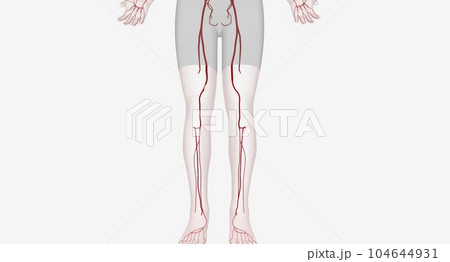 Lower extremity arterial interventions are procedures designed to restore blood flow to your legs and feet 104644931