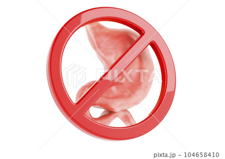 Human stomach with forbidden symbol. 3D rendering 104658410