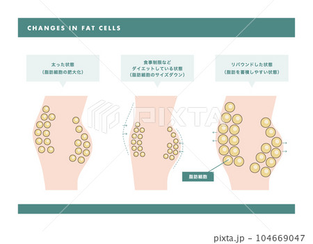 脂肪細胞 皮膚断面図のイラスト 104669047