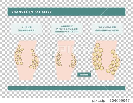脂肪細胞 皮膚断面図のイラスト 104669047