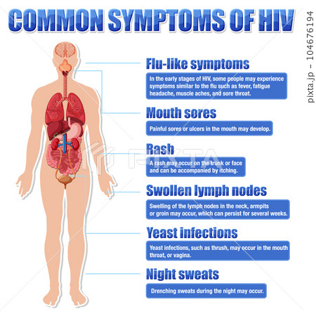 Informative poster of common symptoms of HIV Informative poster of common symptoms of HIV 104676194