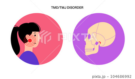 TMD TMJ disorder 104686992