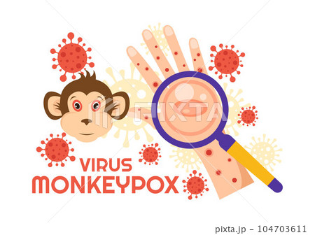 Monkey Pox Outbreak Vector Illustration of Virus Symptoms in Humans Monkeypox Microbiological in Flat Cartoon Hand Drawn Templates Monkey Pox Outbreak Vector Illustration of Virus Symptoms in Humans Monkeypox Microbiological in Flat Cartoon Hand Drawn Templates 104703611
