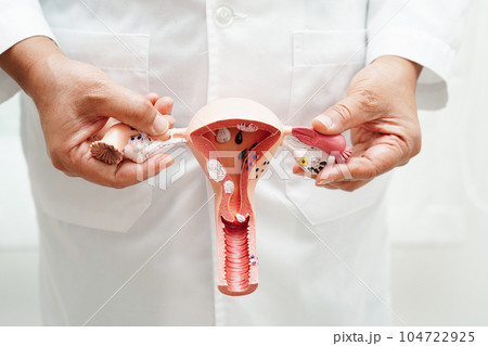 Uterus, doctor holding anatomy model for study diagnosis and treatment in hospital. Uterus, doctor holding anatomy model for study diagnosis and treatment in hospital. 104722925