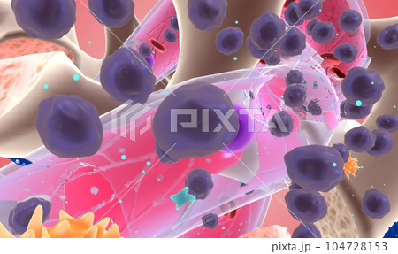 The Multiple Myeloma Cellular Levelのイラスト素材 [104728153] - PIXTA