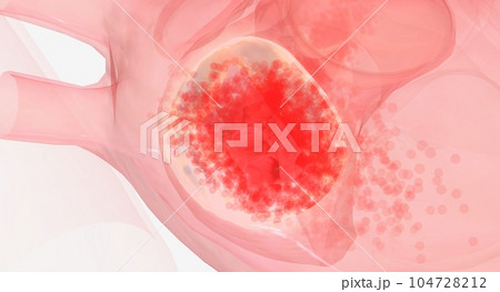 The repaired heart valve is working properly 104728212