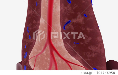 The spleen supports the lymphatic system by filtering blood and producing white blood cells, or lymphocytes 104746950