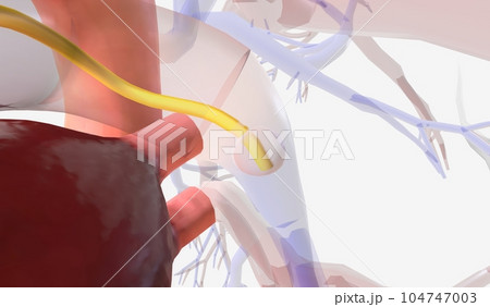 Insertion into the Pulmonary Artery 104747003