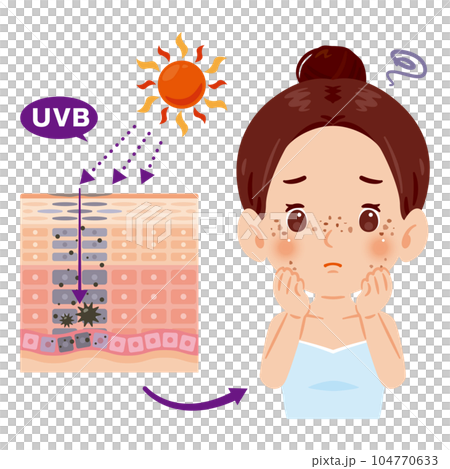 Spots caused by UV rays 2 104770633