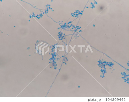 ぶどうの房のように菌糸を伸ばしたカビ 104809442