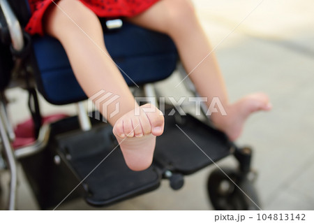 Disabled girl sitting in wheelchair. Close up photo of her legs spasticity muscles . Child cerebral palsy. Disability. Inclusion. Disabled girl sitting in wheelchair. Close up photo of her legs spasticity muscles . Child cerebral palsy. Disability. Inclusion. 104813142