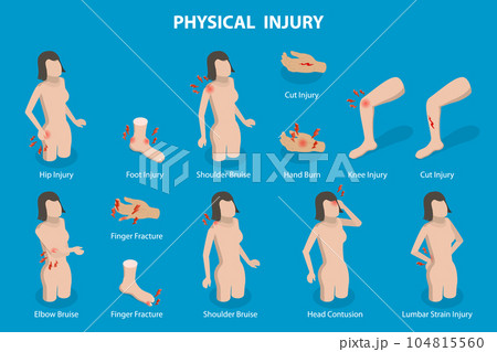 3D Isometric Flat Vector Conceptual Illustration of Physical Injuries 3D Isometric Flat Vector Conceptual Illustration of Physical Injuries 104815560