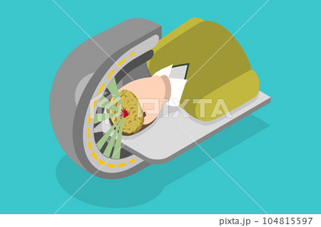 3D Isometric Flat Vector Conceptual Illustration of Gamma Tumor Cancer Treat Exam 104815597