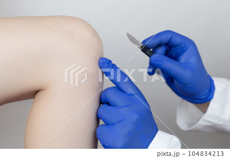 Knee surgery. Orthopedic surgeon shows patient where the incision will be made to repair the tendon, cartilage, and eliminate the effects of arthralgia. Concept of providing qualified care to patients 104834213