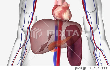 Hypertriglyceridemia is a common condition characterized by high levels of triglycerides (fats) in the bloodstream Hypertriglyceridemia is a common condition characterized by high levels of triglycerides (fats) in the bloodstream 104840111