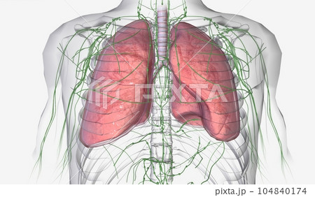 Lung Cancer Stage I 104840174