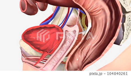 Vaginal Vault Prolapse Grade 1 104840261