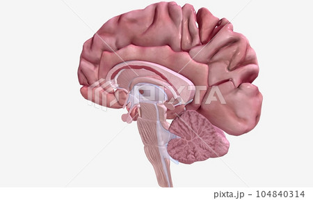 Progression of Multiple Sclerosis Sagittal View Progression of Multiple Sclerosis Sagittal View 104840314