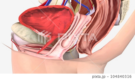 Vaginal Vault Prolapse Grade 2 104840316
