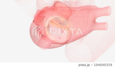 The repaired heart valve is working properly 104840359