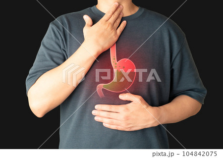 Gastroesophageal reflux disease (GERD) or acid reflux symptoms. Man suffering from heartburn, stomachache, nausea and bloating. Gastrointestinal system disease and digestive problems. Gastroesophageal reflux disease (GERD) or acid reflux symptoms. Man suffering from heartburn, stomachache, nausea and bloating. Gastrointestinal system disease and digestive problems. 104842075