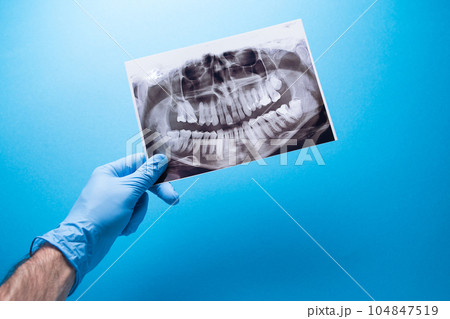 A dentist holding snapshot the patient's tooth and indicates the problem. Panoramic shot of the jaw on a blue isolated background. 104847519