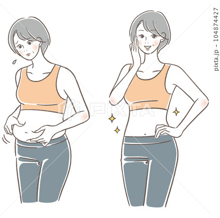 シニア女性のダイエットのビフォア、アフター シニア女性のダイエットのビフォア、アフター 104874427