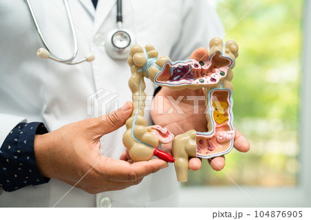Intestine, appendix and digestive system, doctor holding anatomy model for study diagnosis and treatment in hospital. Intestine, appendix and digestive system, doctor holding anatomy model for study diagnosis and treatment in hospital. 104876905