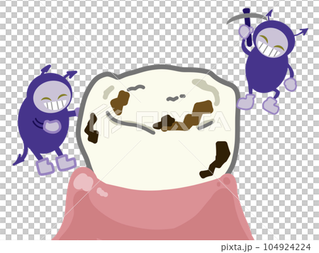 虫歯と虫歯菌 虫歯と虫歯菌 104924224