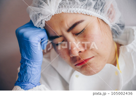 Stressed healthcare worker with facial wounds and acne occur from a medical mask after work for a long time in hospital during covid-19 pandemic. 105002436