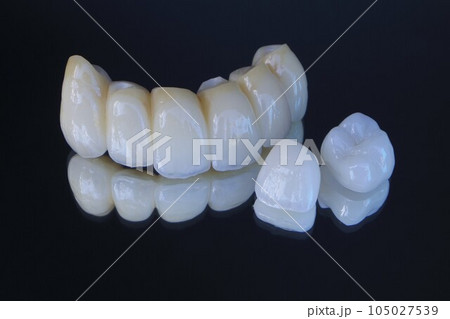 白いきれいな歯を歯医者さんで手に入れよう 105027539